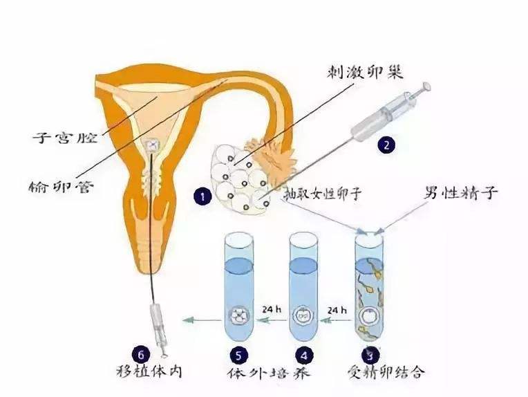 试管第一次检查月经期可以吗